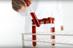 إختبار دم يكتشف 50 نوعا من السرطان