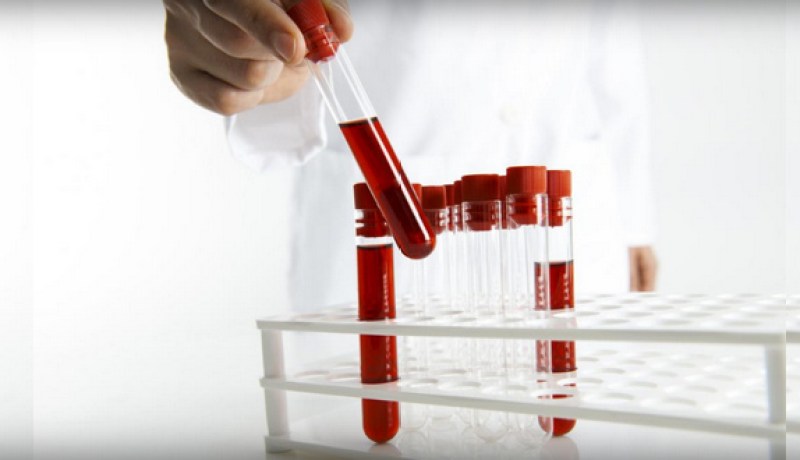 إختبار دم يكتشف 50 نوعا من السرطان