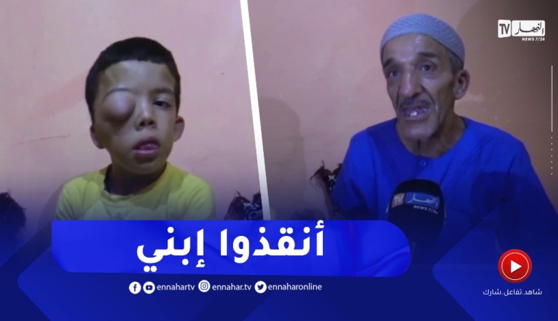 الأغواط / عائلة جودي تناشد المحسنين لإنقاذ إبنها من التشوه االخلقي