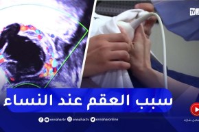 بطانة الرحم المهاجرة.. تسبب لـ30 بالمئة من النساء العقم