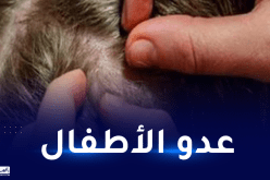 توصية مهمة بخصوص “القمل والمدارس”