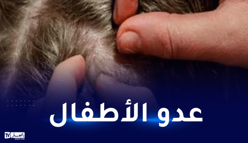 توصية مهمة بخصوص “القمل والمدارس”