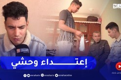 سيد علي.. ضحـ ـية إعتـ ـداء بحمض “الاسيد” ببئر توتة يحكي معاناته