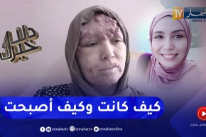 دلال خير: مرض جلدي بسيط يتحول إلى نوع خطير من سرطان الجلد.. إيمان تتجرع مرارة الألم