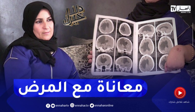 دلال خير: شابة في ربيع العمر أرهقها المرض وأصبحت تبدو أكبر من عمرها بكثير