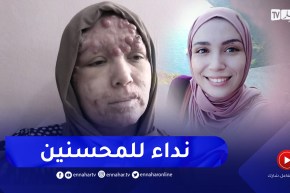 البليدة: مرض سرطان الجلد يُذهب إبتسامة إيمان ويقلب حياتها رأسا على عقب