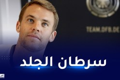 مانويل نوير يصاب بسرطان الجلد