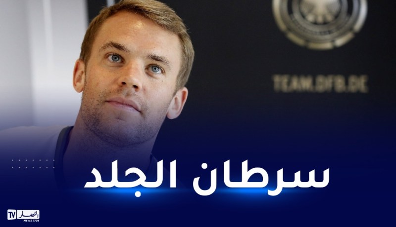 مانويل نوير يصاب بسرطان الجلد