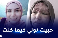 بالفيديو.. مرض نادر يسرق إبتسامة إيمان وأملها في الجزائريين