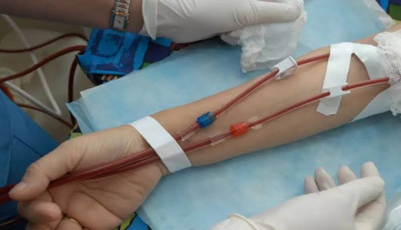 10 بالمائة من الجزائريين يعانون من أمراض الكلى