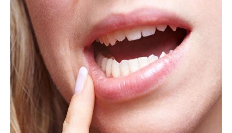 علامات تحذيرية لتجنب أكثر السرطانات شيوعا