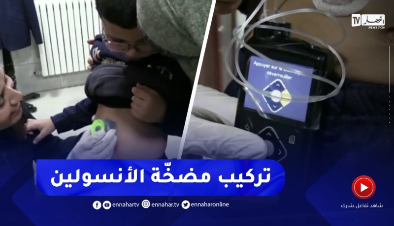تركيب مضخة الأنسولين.. أمل وحياة جديدة لمرضى السكري