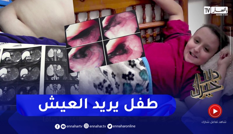دلال خير: طفل يعني من مرض التليف الكبدي في مرحلة متقدمة أمله الوحيد هو زراعة كبد في الخارج