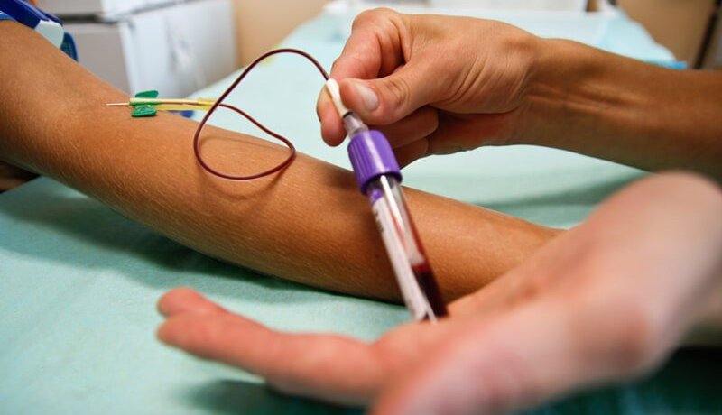 50 بالمائة من حالات فقر الدم سببها النقص الفادح في مادة الحديد بالجسم