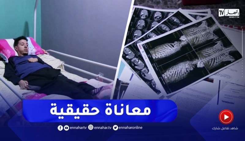 الطارف : آدم قويرة..شاب يأمل الوقوف على رجليه من جديد