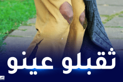 متشرد ضرب شاب مهدد بـ6 سنوات سجنا في العاصمة