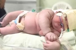 ولادة طفل بوزن يفوق 7 كغ في البرازيل