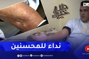 دلال خير: رجل تعرض إلى حادث مرور خطير تسبب له بإعوجاج في العمود الفقري وإصابات أخرى دائمة