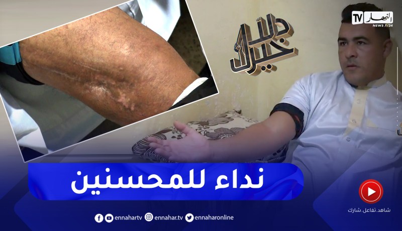 دلال خير: رجل تعرض إلى حادث مرور خطير تسبب له بإعوجاج في العمود الفقري وإصابات أخرى دائمة