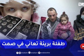 دلال خير: نداء عائلة تتألم على حال إبنتها الوحيدة التي أصيبت بورم في الرأس تسبب لها بفقدان البصر