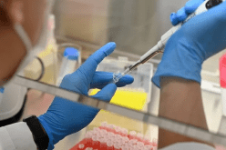 علماء يحددون جينات أكثر مرض قاتل في العالم