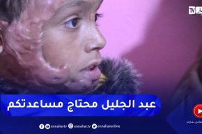 البيض: عائلة الطفل عبد الجليل تطالب المساعدة لإجراء عملية تجميلية لإبنها من آثار الحروق