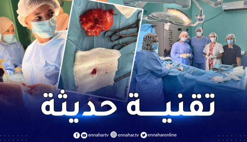 عنابة.. النجاح في اجراء عمليتين لعلاج سرطان الثدي بتقنية جد متطورة