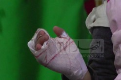 خاصة الحروق.. أخصائيون يحذّرون من الحوادث المنزلية خلال رمضان