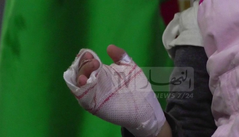 خاصة الحروق.. أخصائيون يحذّرون من الحوادث المنزلية خلال رمضان