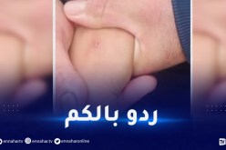 ظاهرة الوخز بالإبر.. الدرك الوطني يوجه نداء للمواطنين