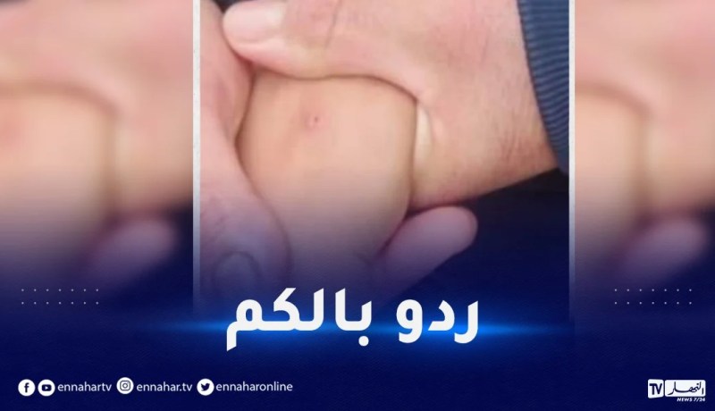 ظاهرة الوخز بالإبر.. الدرك الوطني يوجه نداء للمواطنين