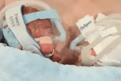 معجزة حقيقية.. توأمان ولدا في الشهر السادس وبقيا على قيد الحياة