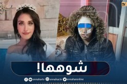 شاب يُشوه وجه جارته ملكة الجمال مروة عادل