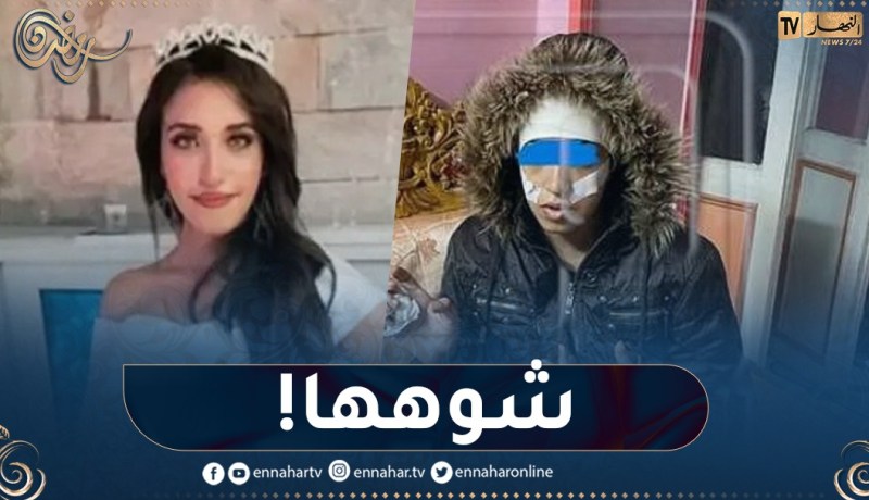 شاب يُشوه وجه جارته ملكة الجمال مروة عادل