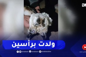 ولادة ماعز برأسين بمزرعة بالشطية 2 ولاية تيارت