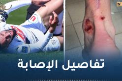 بن طالب يطمئن متابعيه بعد إصابته الخطيرة