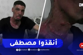 النعامة / مصطفى .. شاب تعرض لحروق يناشد المحسنين مساعدته لإجراء عملية جراحية