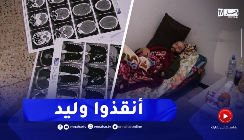 الطارف / الشاب وليد هباش مريض يناشد السلطات لمساعدته في رحلة العلاج بالخارج