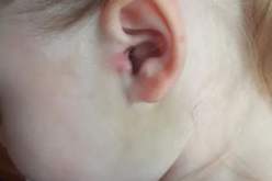 صدمة أم بسبب ما عثرت عليه داخل أذن طفلتها