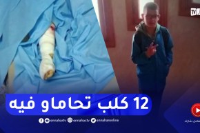 باتنة : 12 كلبا متشردا ينـ.ـهشون جسد طفل حتى المـ.ـوت