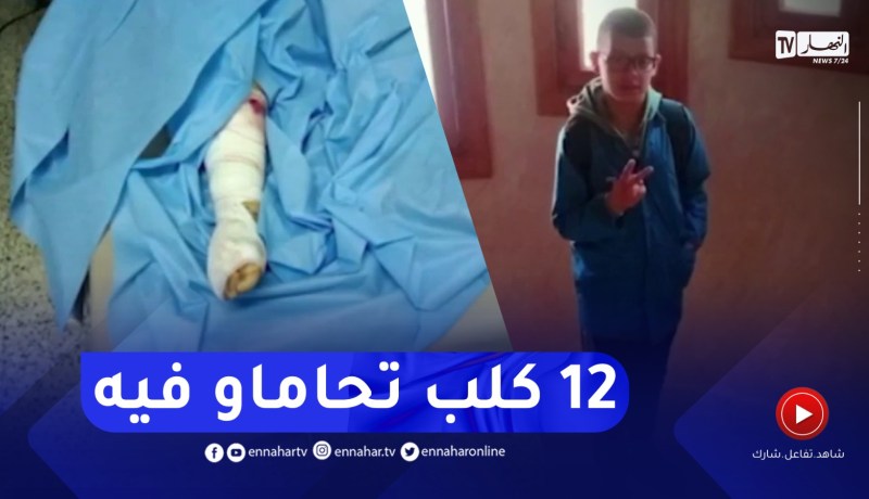 باتنة : 12 كلبا متشردا ينـ.ـهشون جسد طفل حتى المـ.ـوت
