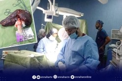 قالمة: فريق طبي بمستشفى الأم والطفل ينجح في استئصال طحال في المرحلة الرابعة من التضخم