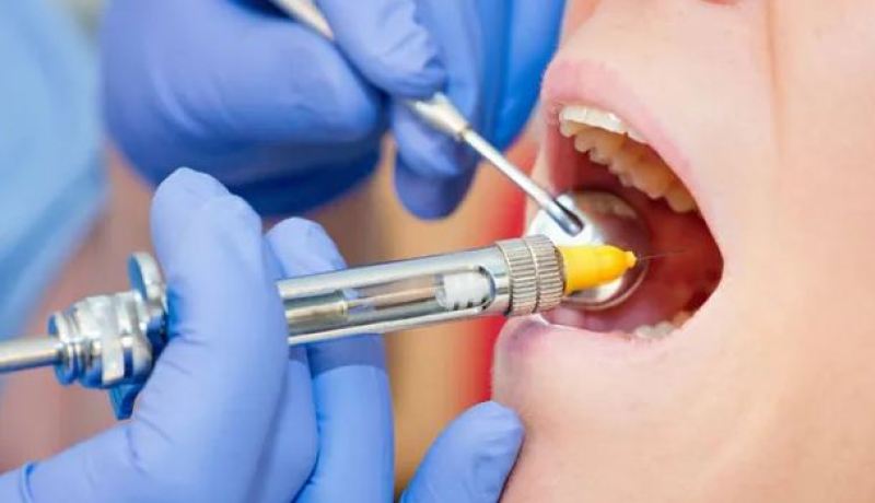 إستلام 485 ألف جرعة من مخدر جراحة الأسنان