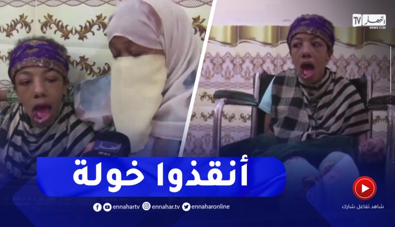 المغير / خولة خمس سنوات من المعاناة بمرض نادر ينخر جسدها