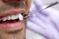 طاقم أسنان يورطّ تاجرا في قضية تهريب الأورو عبر المطار