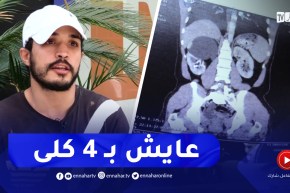 في حالة نادرة.. قصة حسام يعيش بأربع كلى سليمة