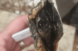 تجربة مُروعة.. أم تحكي تفاصيل إنفجار جهاز مراقبة طفلتها