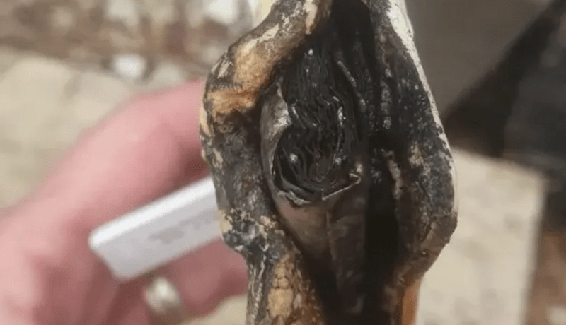 تجربة مُروعة.. أم تحكي تفاصيل إنفجار جهاز مراقبة طفلتها