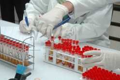 علماء يبتكرون طريقة لمكافحة البكتيريا المقاومة للمضادات الحيوية