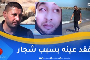 شوفو حكايتي: بعد شجار عنيف شاب يفقد عينه اليسرى.. “معرفتش حتى لقيتو ضربني بمفتاح للعين”
